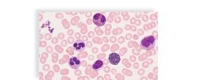 eosinophil platelets Plasma Liquid portion of the Formed Elements Red cells White cells Platelets Formed elements a.