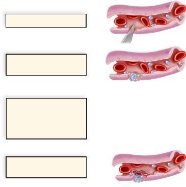 Blood-clotting process 1. Blood vessel is punctured. fibrin threads 2. Platelets congregate and form a plug. red cell Prothrombin activator b. Blood clot 4,400 3.