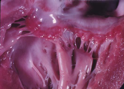AV Valve Valve cusps Chordae tendineae Papillary muscle 13 Here you see the cusps of