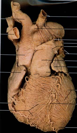 L. Subclavian art. L common carotid art. Anterior View of the Heart Pulmonary veins Pulmonary trunk L. Auricle Ant.