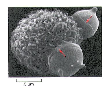 Phagocytosis -particle triggered engulfment of large structures such as bacteria, yeast, remnants of dead cells, arterial