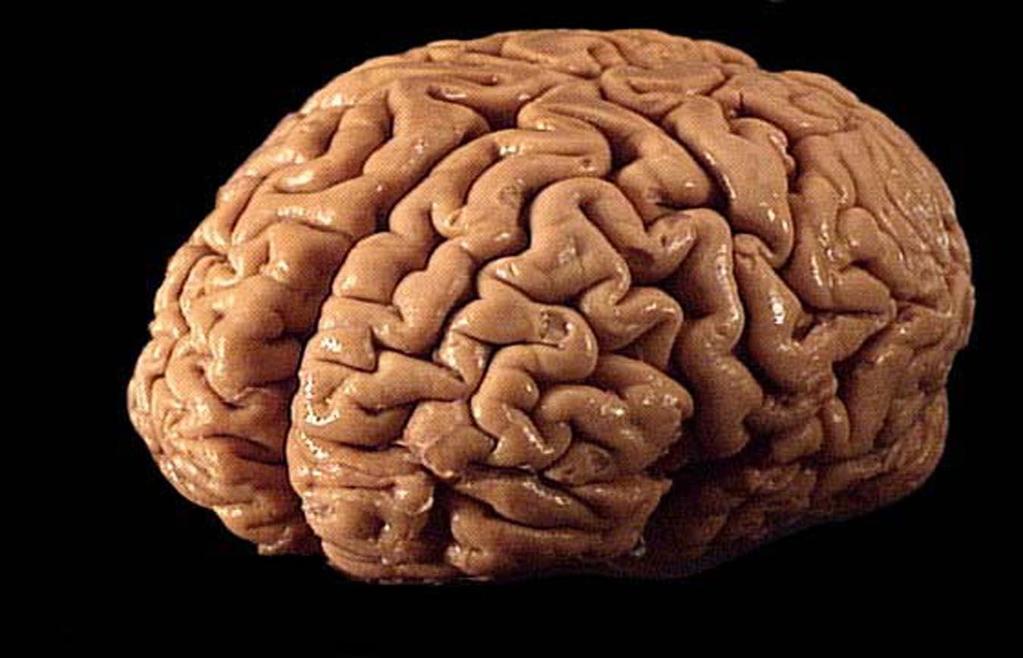 The Brain! The brain has about 100 BILLION neurons all of which are interneurons.