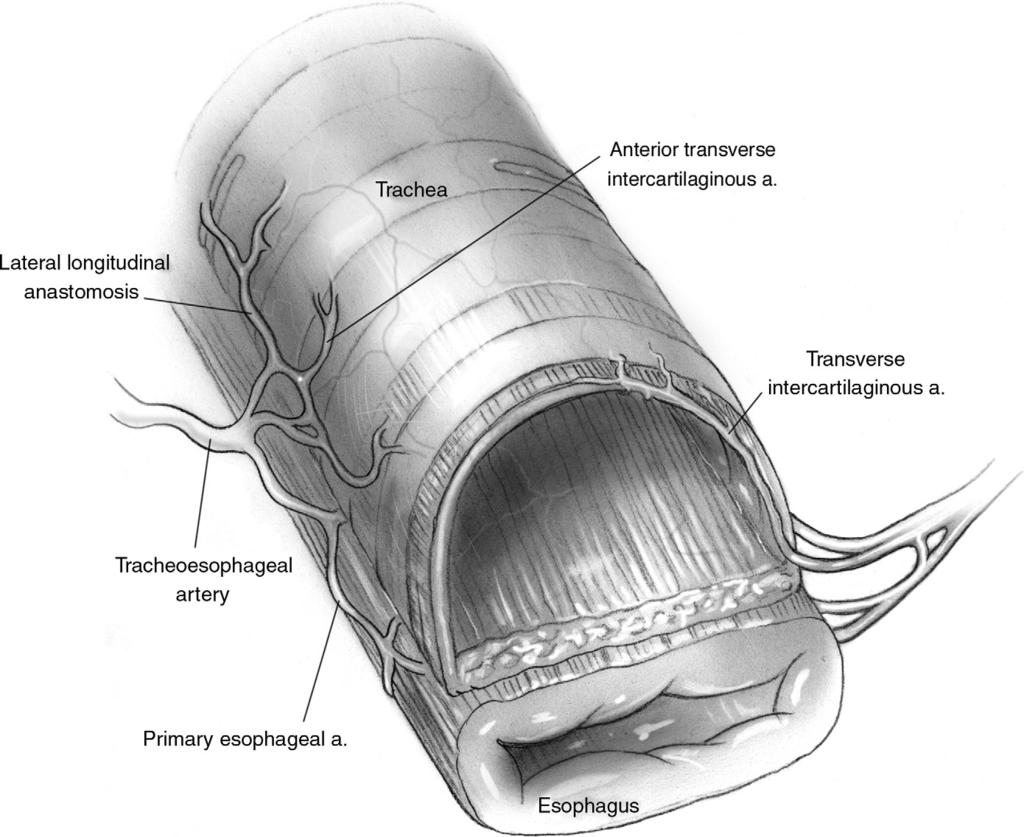 44 N.K. Veeramachaneni and B.F. Meyers Figure 4 The trachea in an average adult is 10 to 11 cm in length. It comprises 18 to 22 cartilaginous rings.