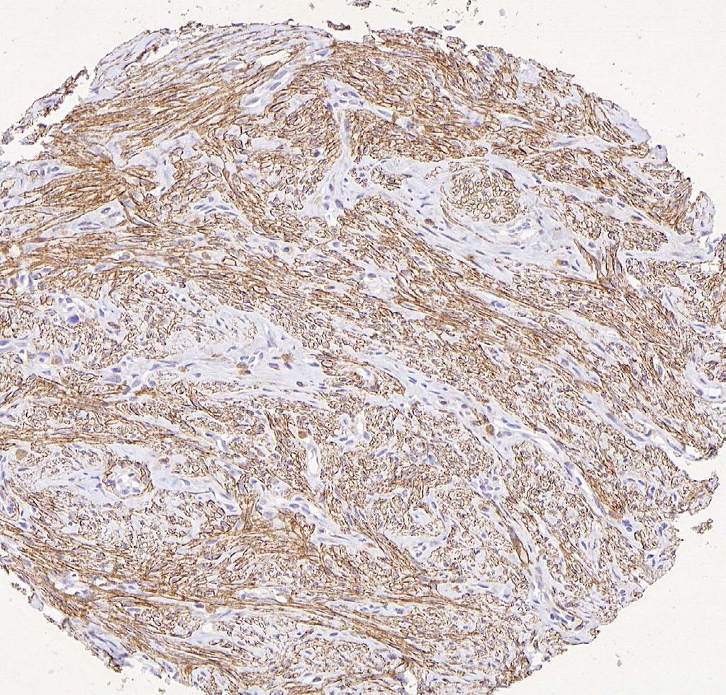 Immunohistochemical detection in formalin-fixed