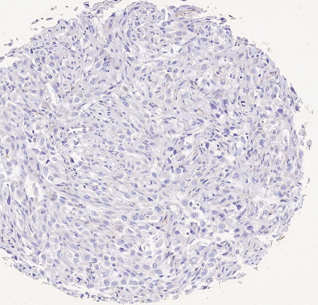 bottom panel; LMS, leiomyosarcoma).