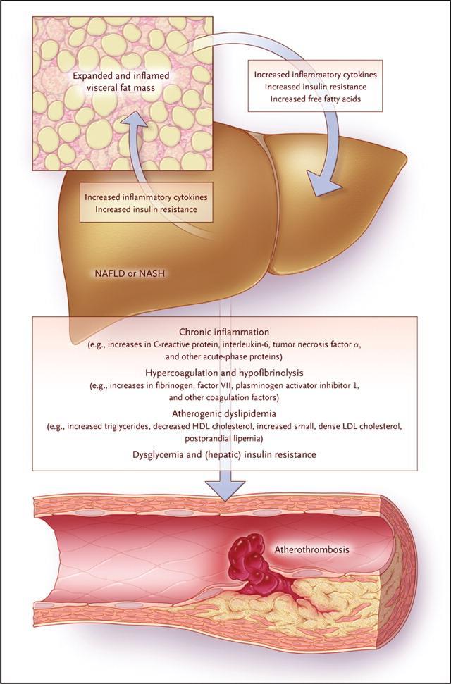 Possible Mechanisms Leading to Cardiovascular Disease in Patients with