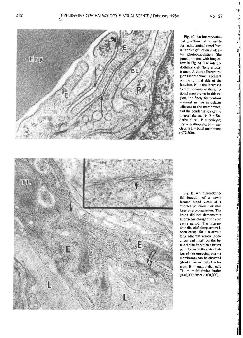 212 INVESTIGATIVE OPHTHALMOLOGY & VISUAL SCIENCE / Februory 1986 Vol. 27 Fig, 10.