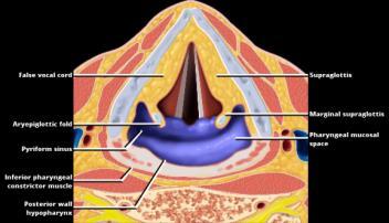 T staging: hypopharynx T1 = tumor 2cm and in one subsite T2 = tumor >2cm and 4cm OR invades >1 subsite T3 = tumor >4cm OR