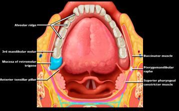 Oral cavity Mucosal lip Buccal mucosa Upper/lower alveolar ridge Retromolar gingiva (RMT) Floor of mouth Hard palate Oral tongue T staging: oral cavity (& lip) T1 = tumor 2cm, 5mm DOI T2 = tumor 2cm,
