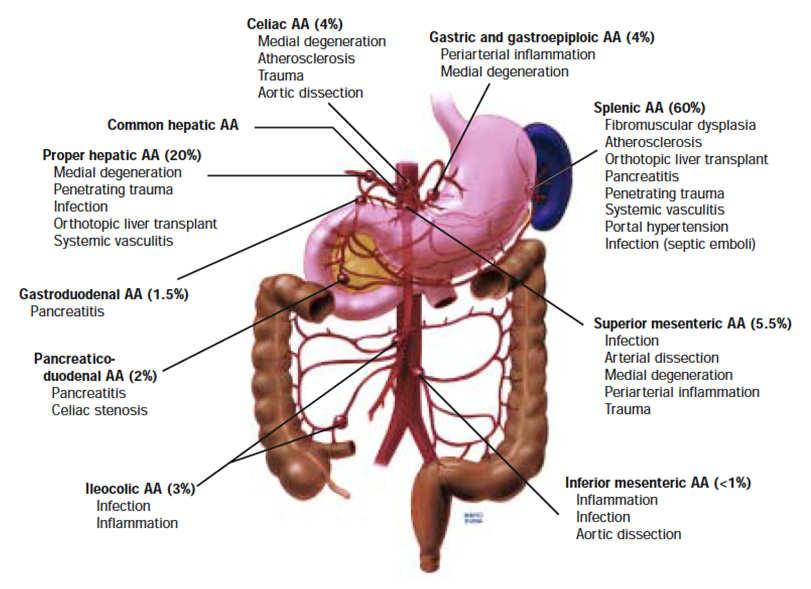 Visceral Artery Aneurysms (VAAs) Incidence: 0.
