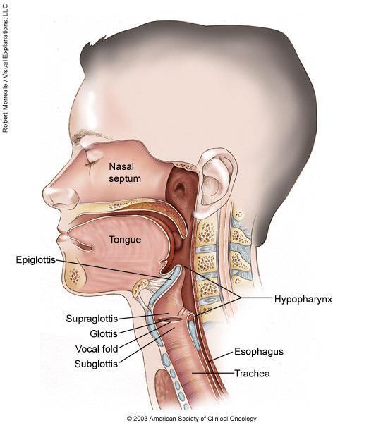 Clinical Background Laryngeal Cancer: Supraglottis (epiglottis, arytenoids,