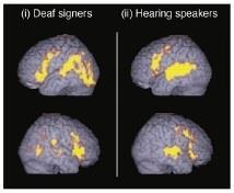 Neuroimaging Imaging research shows that language centres work as well with a signed language as a