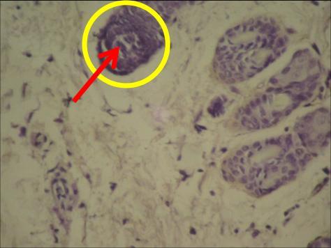 Expression of p53 in rats mammary by IHC