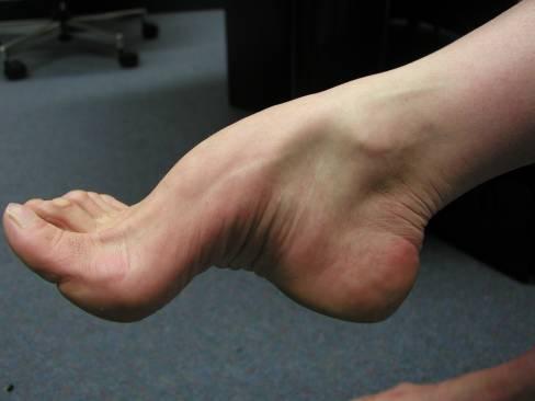 Ankle or Above