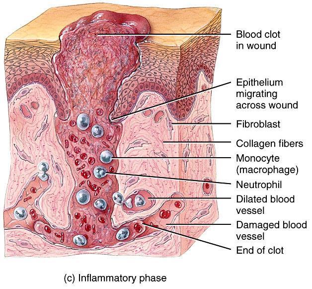 Deep Wound Healing Injury extends into dermis & hypodermis Scar tissue is formed Some normal function