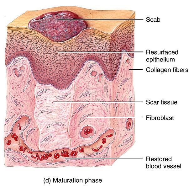 Maturation Phase Scab sloughs off once epidermis restored to normal thickness Granulation tissue developing into scar tissue Fibroblasts decrease in number Blood vessels restored