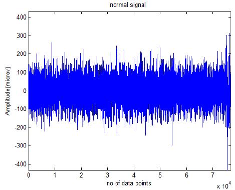 Relative wavelet entropy(rwe) the alpha band having higher RWE values indicate larger mental activity and also seen