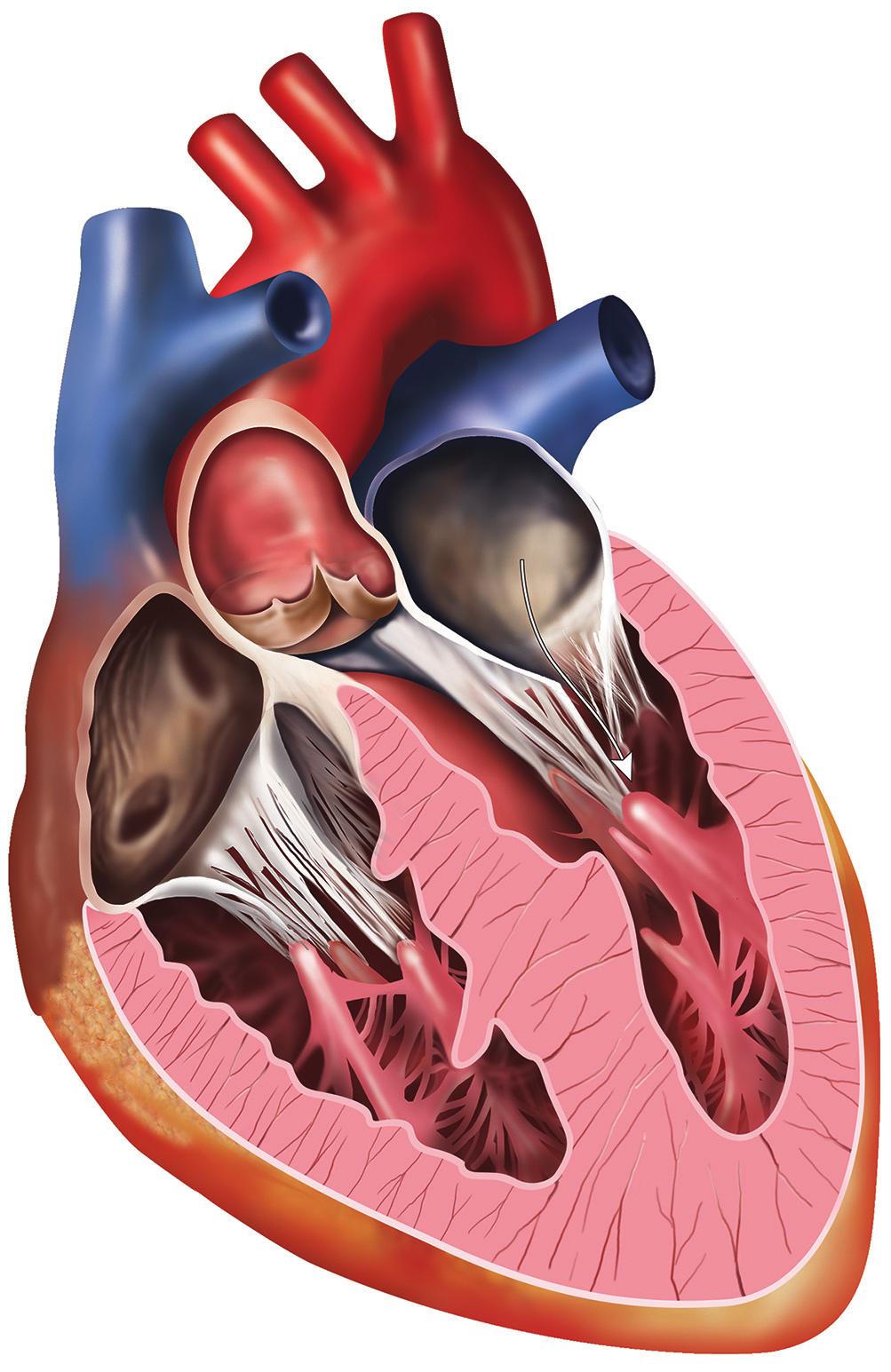 What is mitral valve disease? Your heart is a muscle that pumps oxygen-rich blood from your lungs around your body and oxygen-poor blood from your body to your lungs.