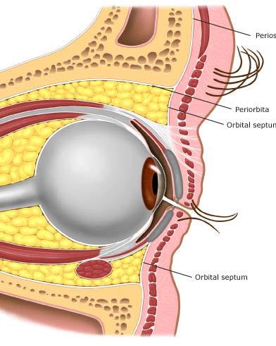 Orbital Septum Orbital Cellulitis Tissues within the orbit posterior to the