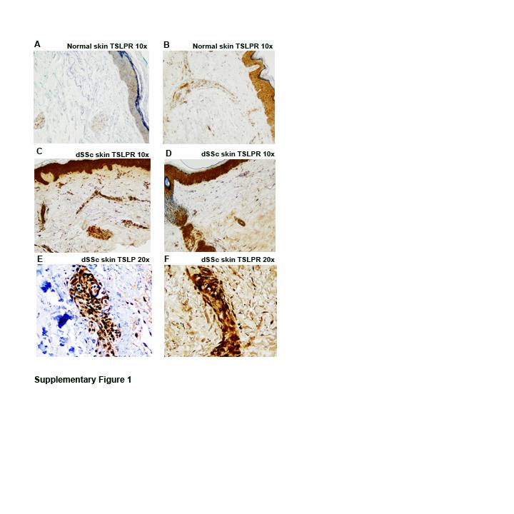 Supplementary Figure 1: TSLP receptor skin expression in dcssc. A: Healthy control (HC) skin with TSLP receptor expression in brown (10x magnification).