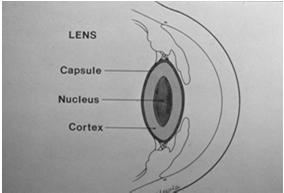 Crystalline Lens Nucleus Cortex Capsule Accommodation Cataract Cataract Cilary Body