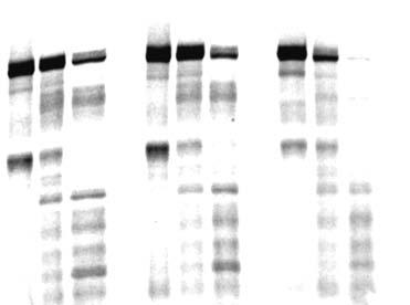 kd 150 75 Undigest 50 37 25 Trypsin (µg/ml) 0 1 2.5 10 0 1 2.5 10 T440A 0 1 2.5 10 Y358A Supplementry figure S16. Trypsin clipping ssy of, T440A mutnt nd Y358A mutnt.