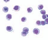Grnulocytic cells PUGNAc