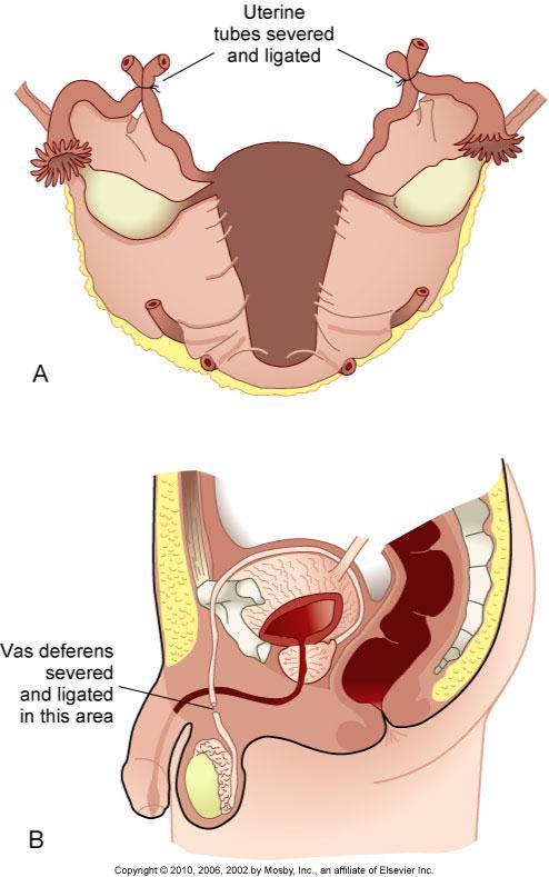 Fig. 7-15. Sterilization.