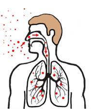 Risk Factors for TB Infection The chance of INFECTION Increases when The concentration of