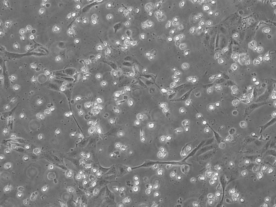 Influenza Growth in Tissue Culture Mock infected control, MDCK cells 2 days post infection, 100x phase contrast Influenza A virus A/Hong Kong/8/68 (H3N2) (ATCC VR-1679 ) in MDCK cells 2 days post