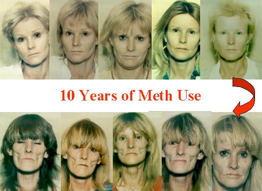 The Face of Meth ** Maintain current photo for patient s chart ** What We See in