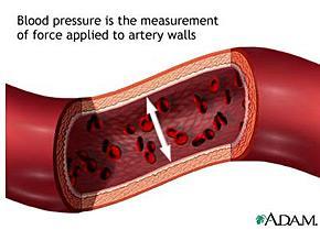 Effects of HTN Over the time the arterial wall becomes more stiff