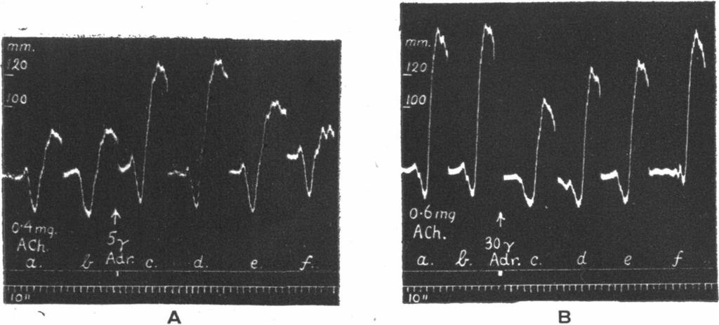 B. BtLBRING AND J. H. BURN 296 at 120 mm. The injection of 2 mg. acetylcholine produced no appreciable rise, and indeed there was a slight fall despite the injection of 2 mg. atropine just A B Fig. 4.
