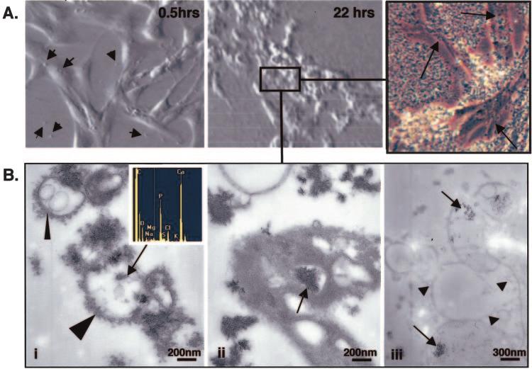 J Am Soc Nephrol 15: 2857 2867, 2004 Calcium and Phosphate Induce VSMC Calcification 2861 Figure 3. VSMC calcification is mediated by vesicle release.
