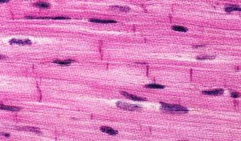 Muscle Tissue Bundles of long cells