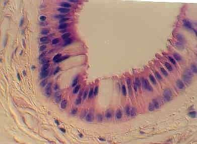 Stratified columnar epithelia Description: Multilayered, superficial cells elongated and