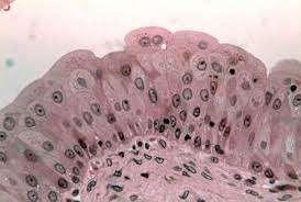 Transitional epithelia Description: Characterized by