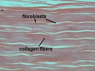 CT proper: dense CT; Regular Description: Primarily parallel collagen fibers; a few elastin fibers; major cell type