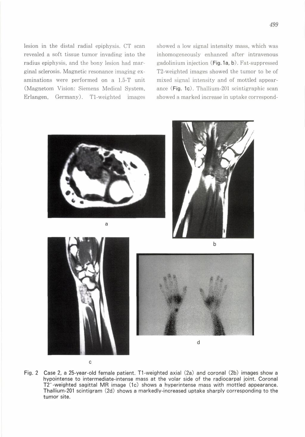 499 lesion in the revealed radius ginal a soft sclerosis. (Magnetom Erlangen, radial tissue epiphysis, aminations Fig. 2 distal epiphysis.