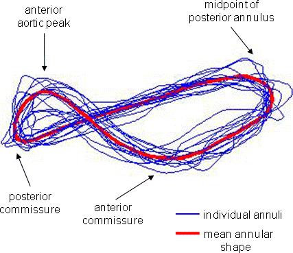 VARIABILITY IN NORMAL MITRAL ANNULAR
