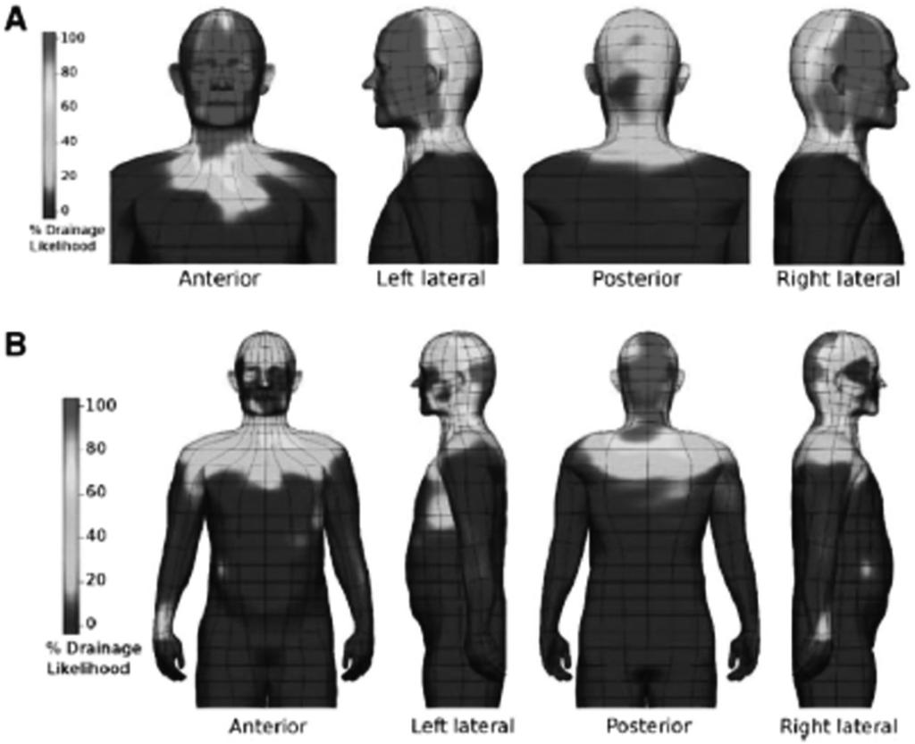 REGIONAL MANAGEMENT OF MELANOMA IN THE CLINICALLY NODE-NEGATIVE NECK 359 Figure 25 4. Head and neck lymphatic drainage patterns.