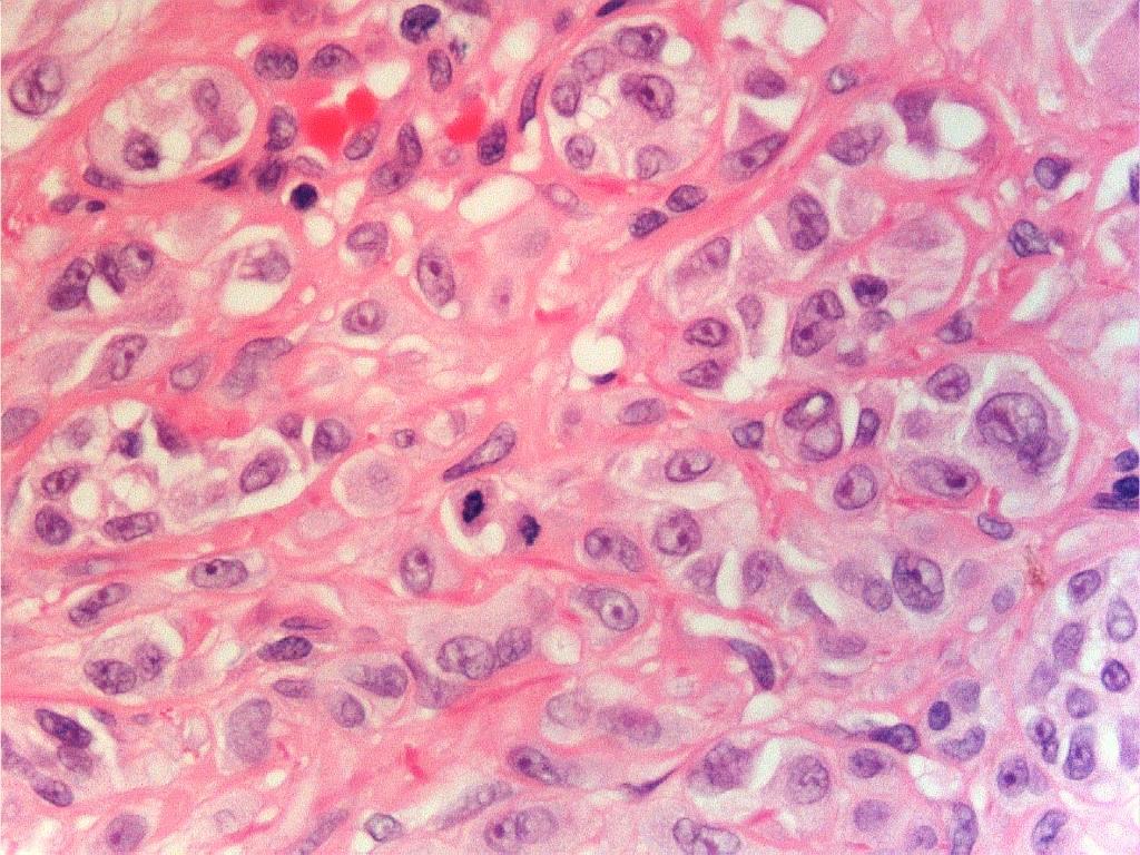 mitoses and