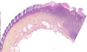 clinical morphological features IHC