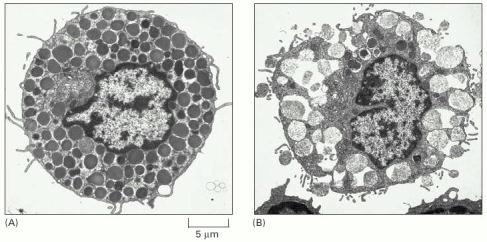 Electron micrographs of