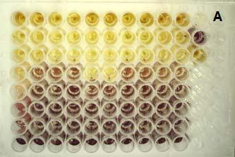 Keser B. Protimikrobno delovanje izvlečkov listja in grozdnih kožic vinske trte (Vitis Vinifera L.) na patogene bakterije živil.
