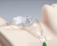 Twill Trach ties will be knotted (rather than a bow) to ensure that it won t come undone Perform oral care every 4 hours to prevent pneumonia Oxygen Delivery PCU Series - 2015 25