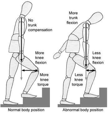 Patella femoral contact force is affected by body position, decreasing as patients forward flex at the hip