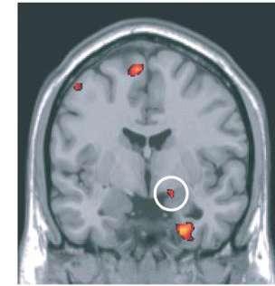 Brain Imaging Different
