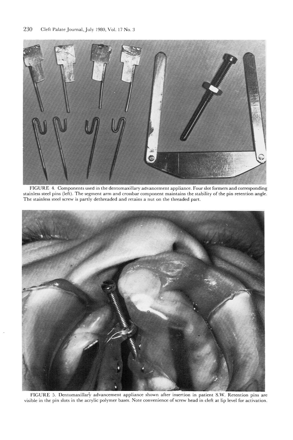 230 Cleft Palate Journal, July 1980, Vol. 17 No. 3 FIGURE 4. Components used in the dentomaxillary advancement appliance. Four slot formers and corresponding stainless steel pins (left).
