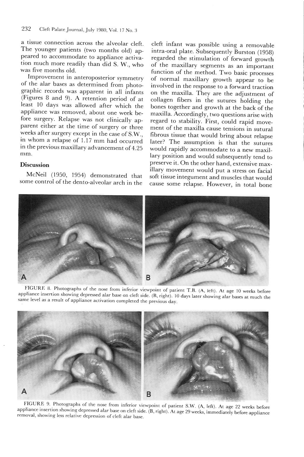 232 Cleft Palate Journal, July 1980, Vol. 17 No. 3 a tissue connection across the alveolar cleft.